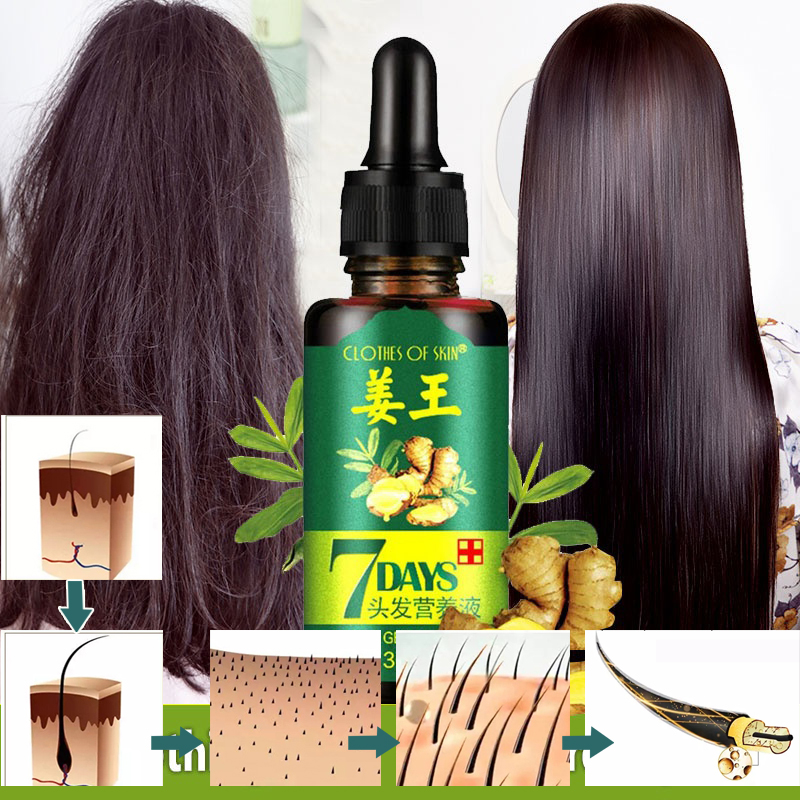 Tinh chất Gừng 7Days chống Hói, tăng trưởng tóc, dưỡng tóc từ 100% với tinh chất kết hợp các Thảo dược tư nhiên Atin Store