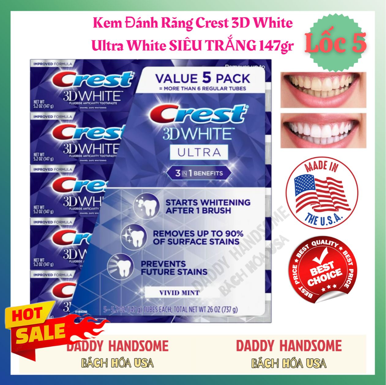 Lốc 5 kem đánh răng crest 3d white siêu trắng ultra vivid mint 147gr chính hãng mỹ
