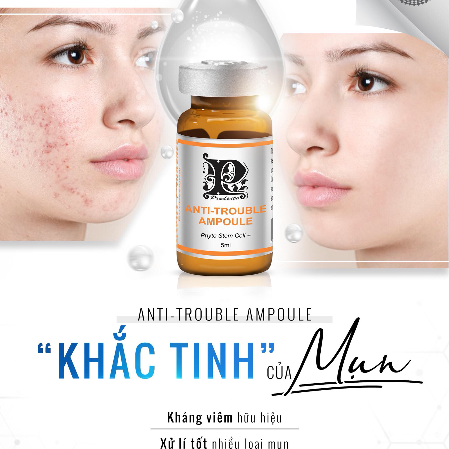 Tinh chất giảm mụn mờ thâm tận gốc Nuwhite Mibiti Prudente Anti Trouble Ampoule 5ml