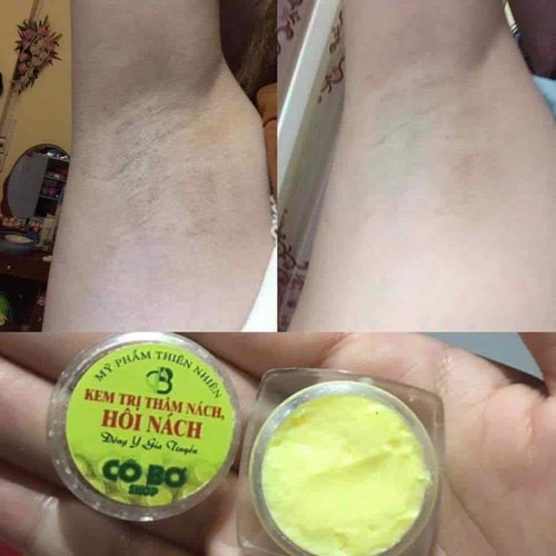 Kem loại bỏ thâm , khử mùi hôi nách Cô Bơ giảm thâm vùng kín đầu gối khuỷu tay chân - Hết hôi sau 3 ngày , hết thâm sau 7 ngày