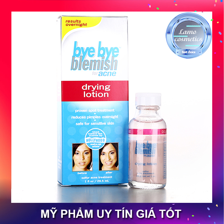 Chấm Mụn Bye Bye Blemish For Acne Drying Lotion