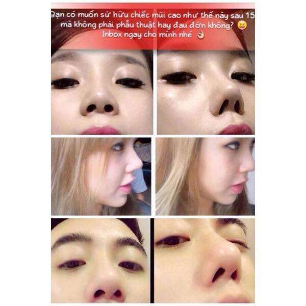 [HCM] Dụng Cụ Nâng Mũi 3D Chuyên Dụng Không Cần Phẫu Thuật