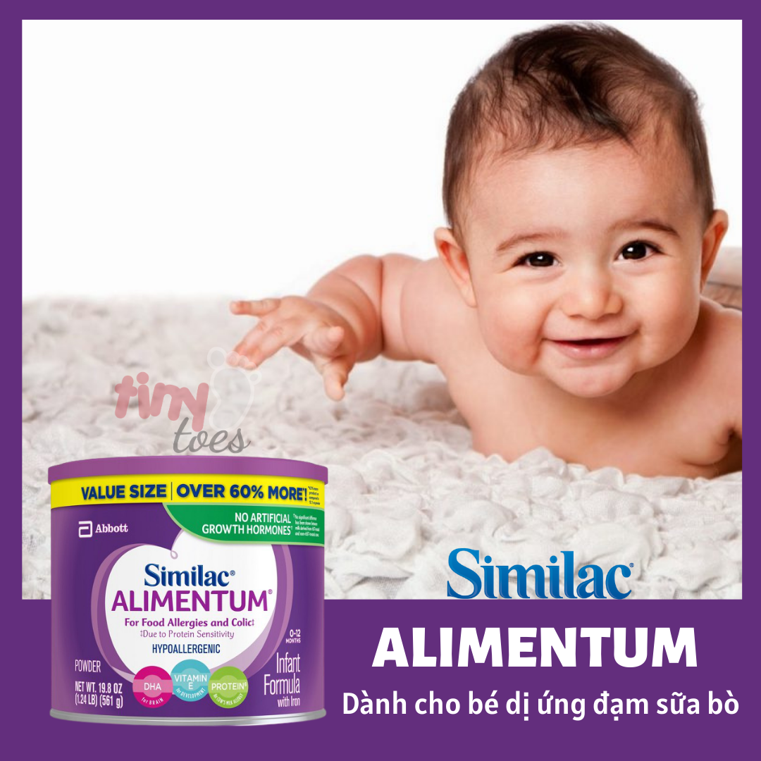 Sữa bột Similac Alimentum cho bé dị ứng đạm sữa bò với đạm thủy phân toàn phần, bổ sung DHA và ARA và các chất dinh dưỡng đặc biệt giúp phát triển thị lực và trí não, hộp thiếc 561g, Mỹ