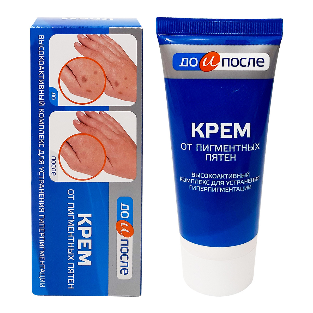 Kem loại bỏ đồi mồi, đốm nâu và dưỡng trắng da tay kpem nga
