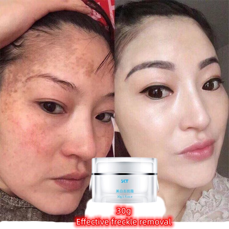 Kem dưỡng trắng da mặt 30g Chống lão hóa Dưỡng Trắng Da dưỡng ẩm xóa nám,Tàn Nhang mờ thâm nám da mặt