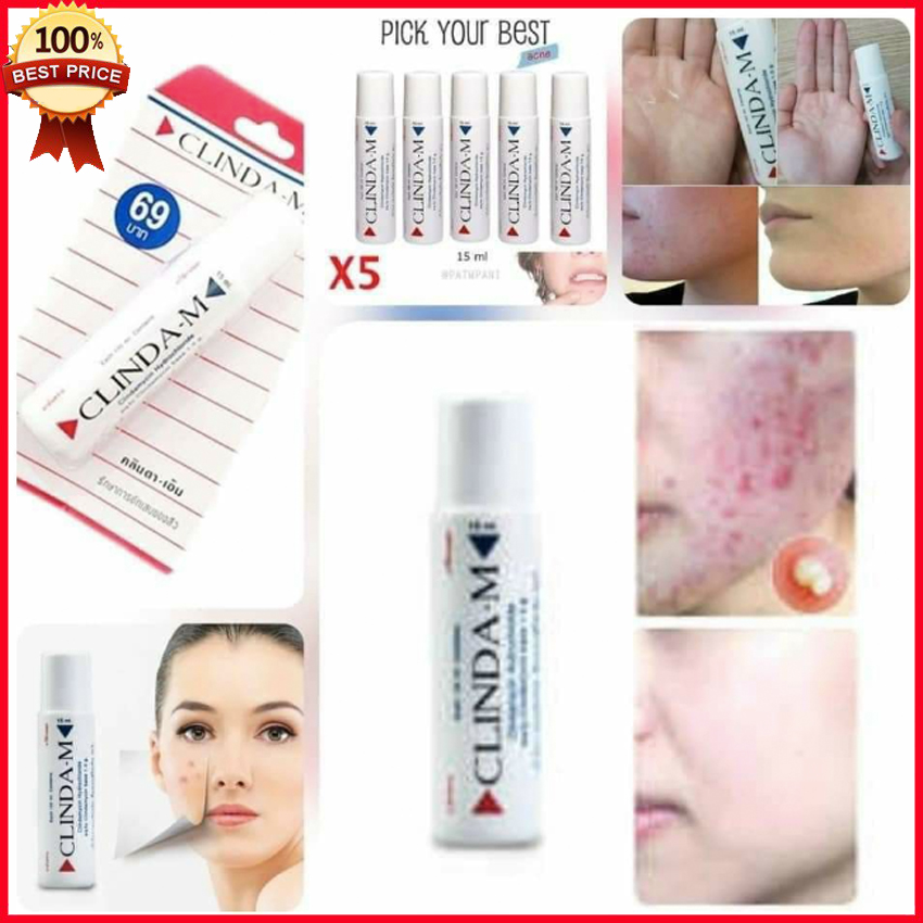 Gel chấm mụn Clinda-M chính hãng Thái Lan 15ml - Giảm mụn trứng cá, giảm các vết thâm và ngăn các đợt bùng phát mới