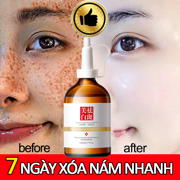 Tinh chất làm trắng sạch tàn nhang 100ml serum dưỡng trắng da căng bóng