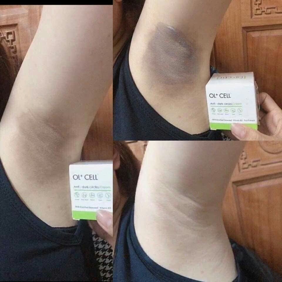 [HCM][H]  CHÍNH HÃNG kem trị thâm làm trắng vùng nách，khử mùi hôi vùng nách，trị thâm vùng kínđầu gốikhuỷu tay chân