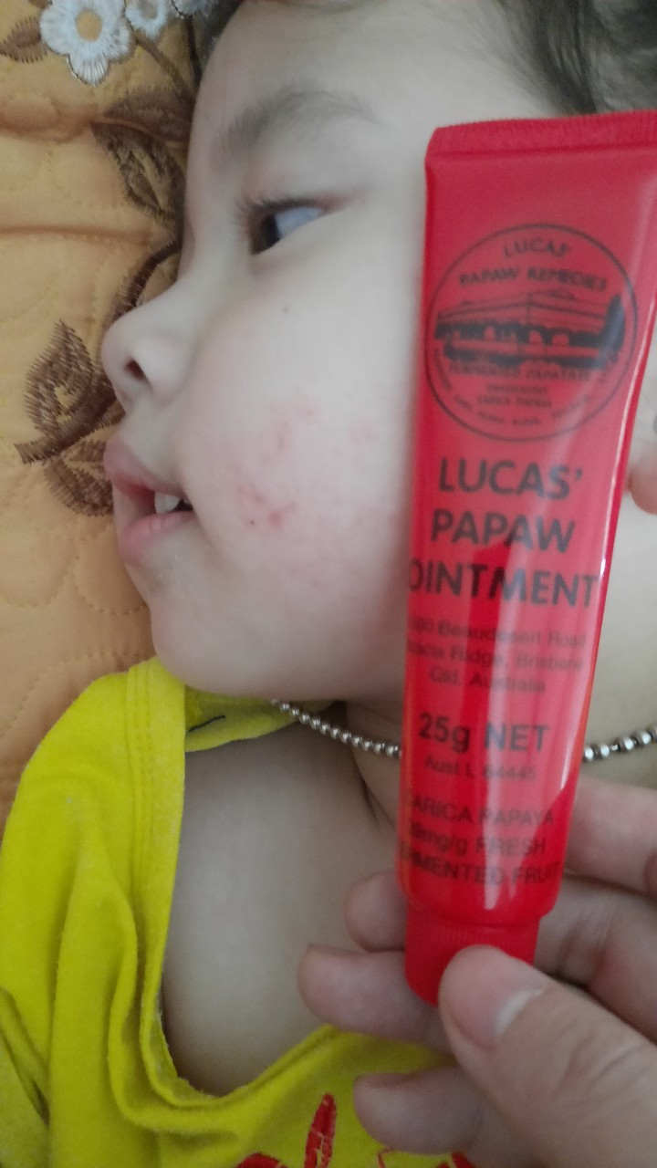 Kem đa năng lucas papaw Ointment 25gr Úc