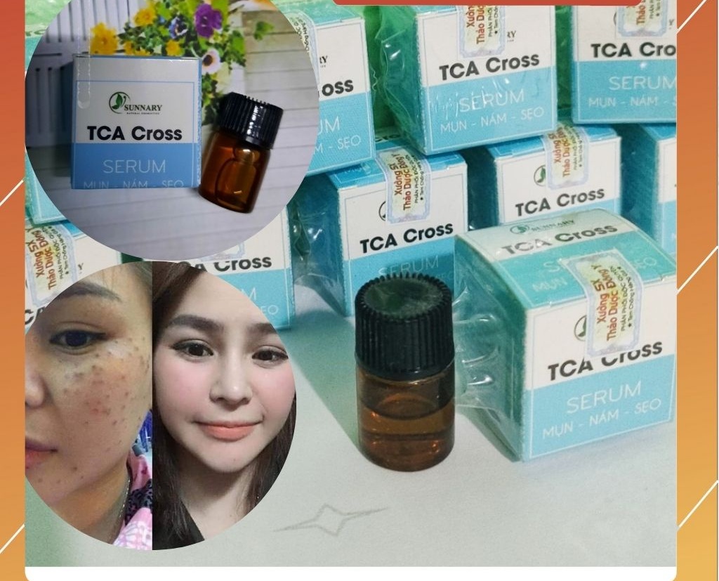 Chấm mụn nám tàn nhang lấp đầy sẹo rỗ 7 ngày bong Nám mụn ruồi