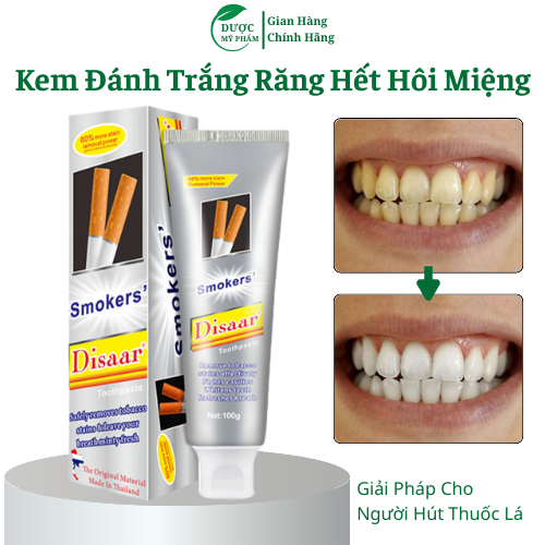 chuẩn ( CHÍNH HÃNG) Kem đánh răng giành cho tất cả những ai hút thuốc lá lào... răng lâu ngày ố vàng. trắng bay tỏng nốt nhạc 100ML