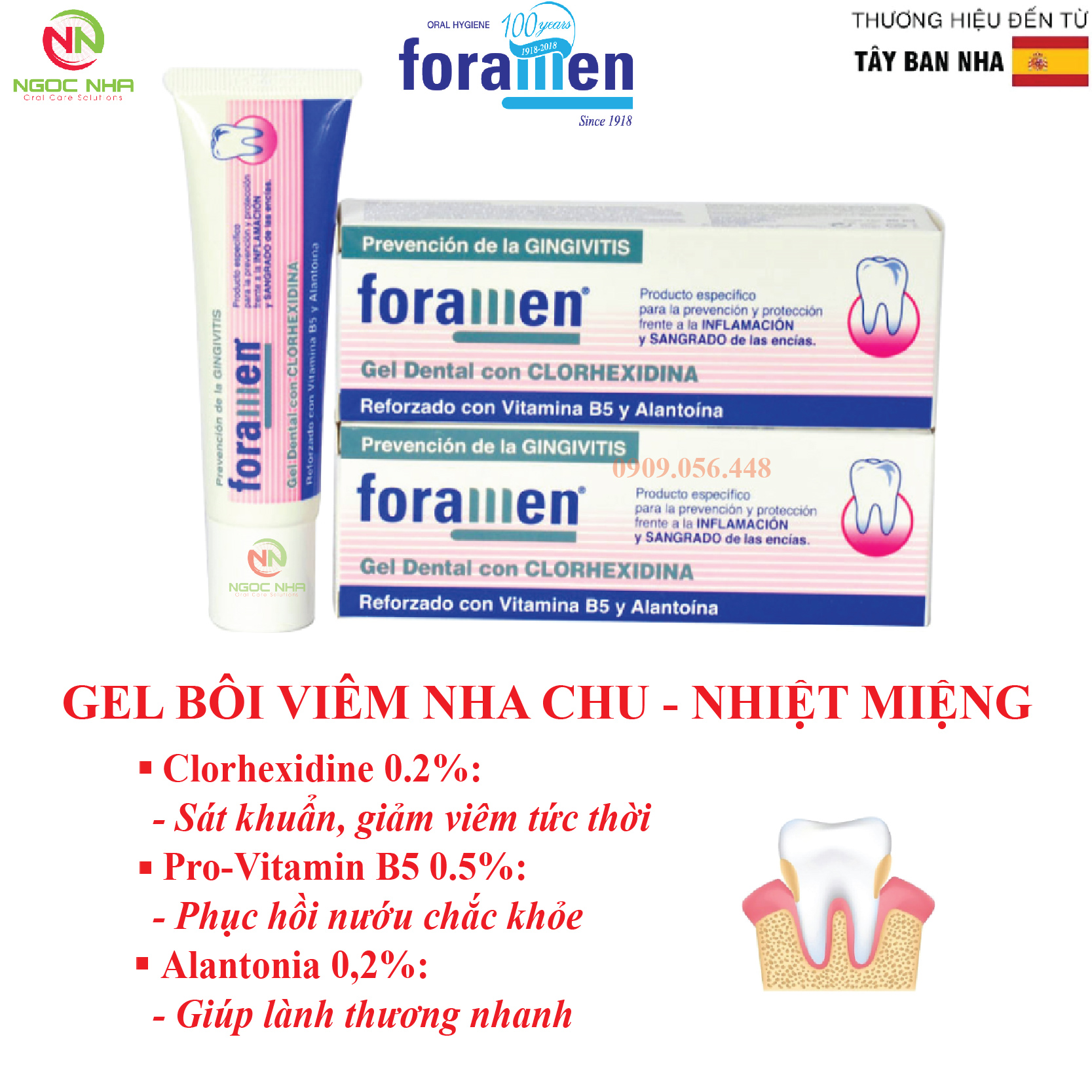 Gel bôi nha chu viêm nướu chảy máu chân răng nhiệt miệng loét miệng nhạy cảm chầy xước do đeo hàm giả hàm tháo lắp Foramen 30ml/ Tây Ban Nha