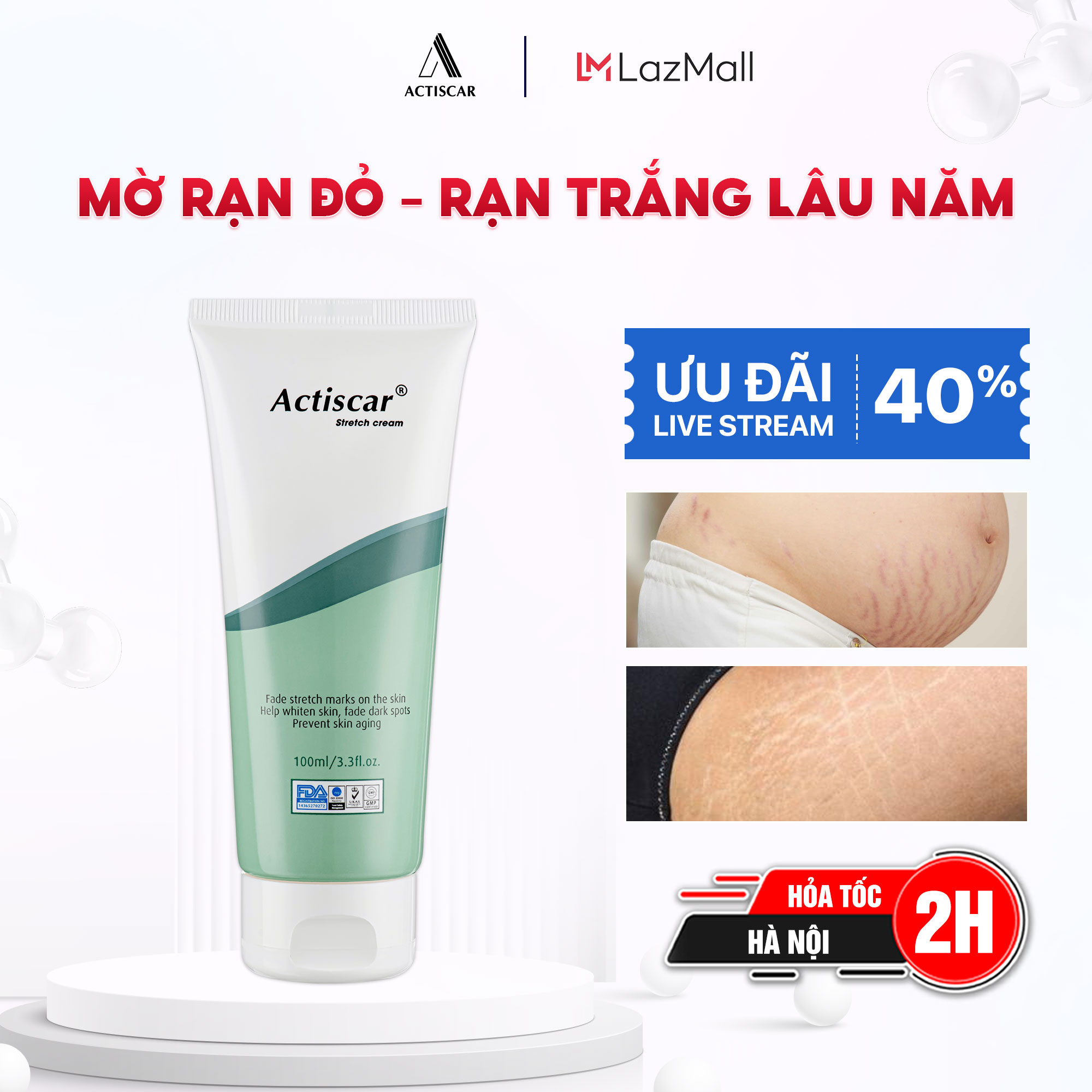 Kem Rạn Da Actiscar 100ml Stretch Làm Mờ Rạn Da, Mờ Sẹo, Đều Màu Da Sau Sinh