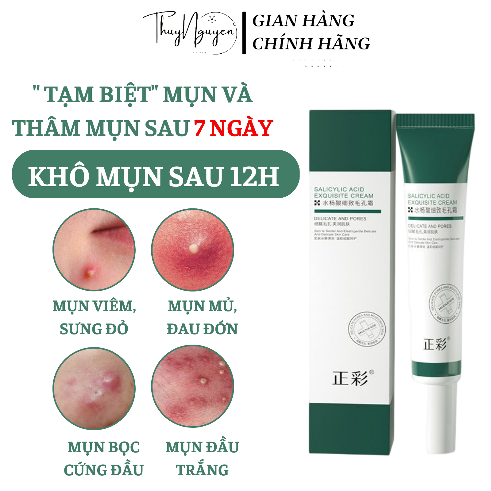 [ CHÍNH HÃNG] Kem chấm mụn HẾT MỤN 100% SẠCH MỤN TẬN GỐC AXIT SALICYLIC hiệu quả hết mụn siêu tốc ngừa sẹo thâm 20g