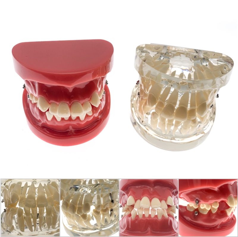 Chăm sóc răng miệng Nha Khoa mô hình răng nha sĩ chỉnh nha mô hình trình