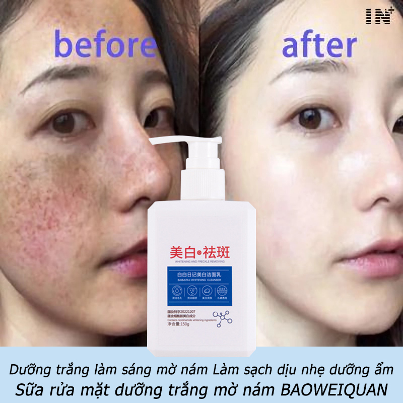 Sữa rửa mặt dưỡng trắng xóa nám cấp nước giữ ẩm diệt mạt loại bỏ mụn đầu đen kiểm soát dầu làm sạch sữa rửa mặt niacinamide