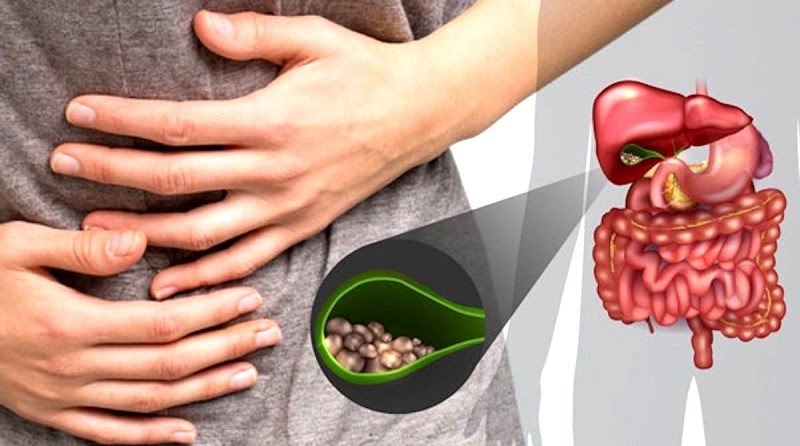 Đậu phộng phòng ngừa bệnh sỏi mật