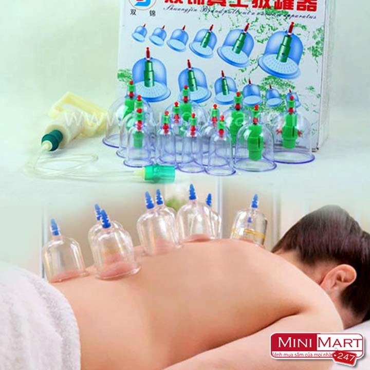 Bộ giác hơi không cần lửa 12 ly kèm 1 ống bơm chuyên dụng