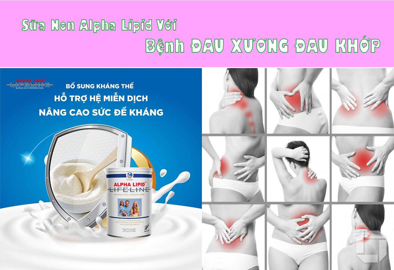 Sữa non ALPHA LIPID