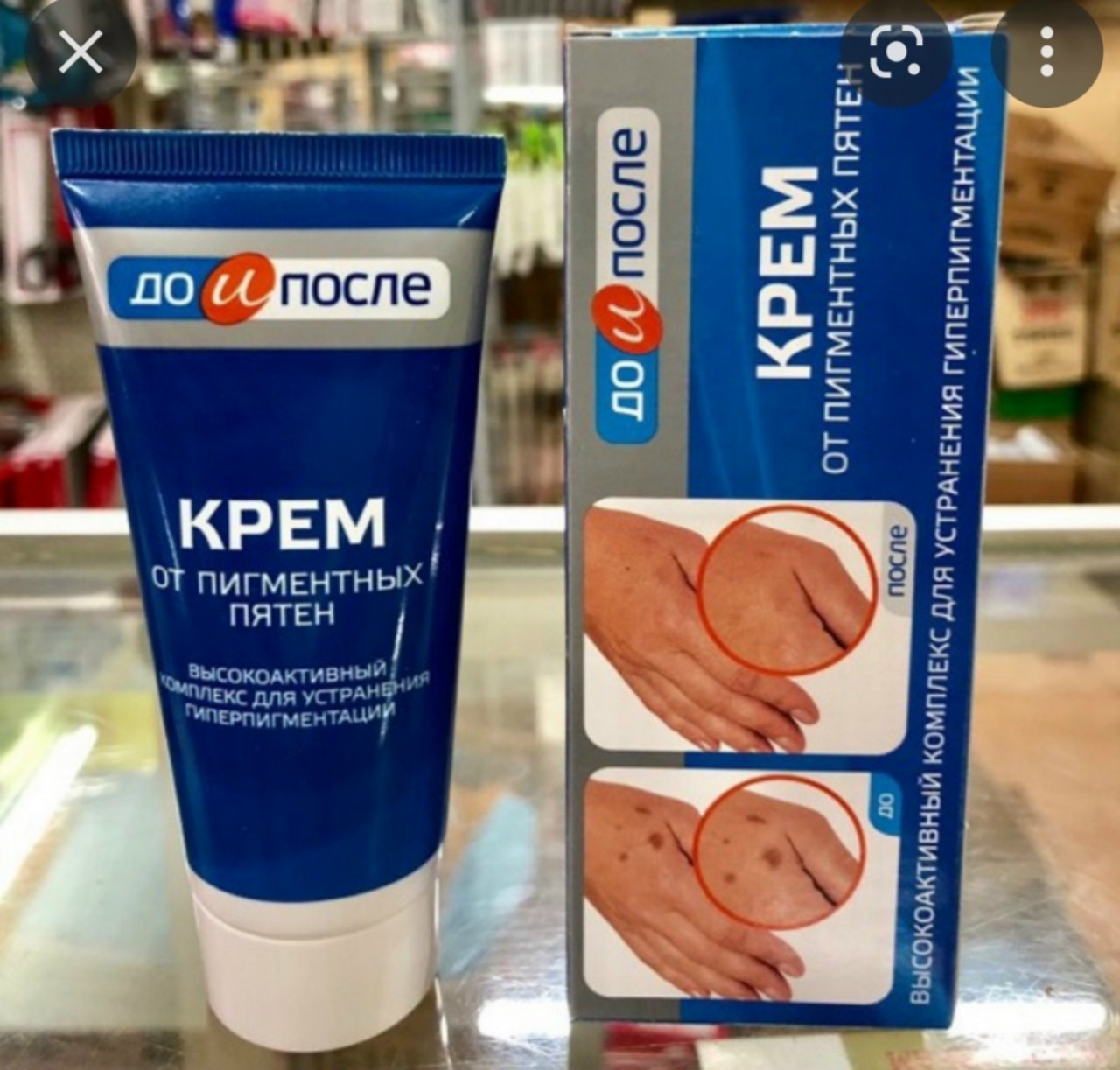 Kem trí đồi mồi tay chân kpem