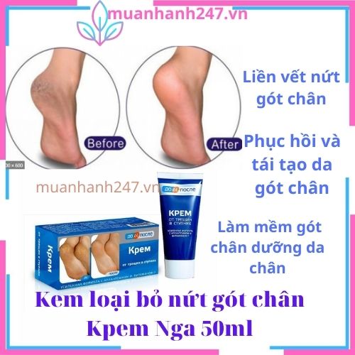 Kem hết nứt gót chân Nga,Kem Ngăn Ngừa Và Hồi Phục Nứt Nẻ Gót Chân dưỡng da chân Kpem 50ml