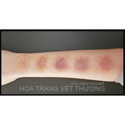 VẾT THƯƠNG BẦM TÍM - THÂM ĐEN - VẾT THƯƠNG ỬNG ĐỎ - MÀU HÓA TRANG HALLOWEEN - MÀU LÀM VẾT THƯƠNG