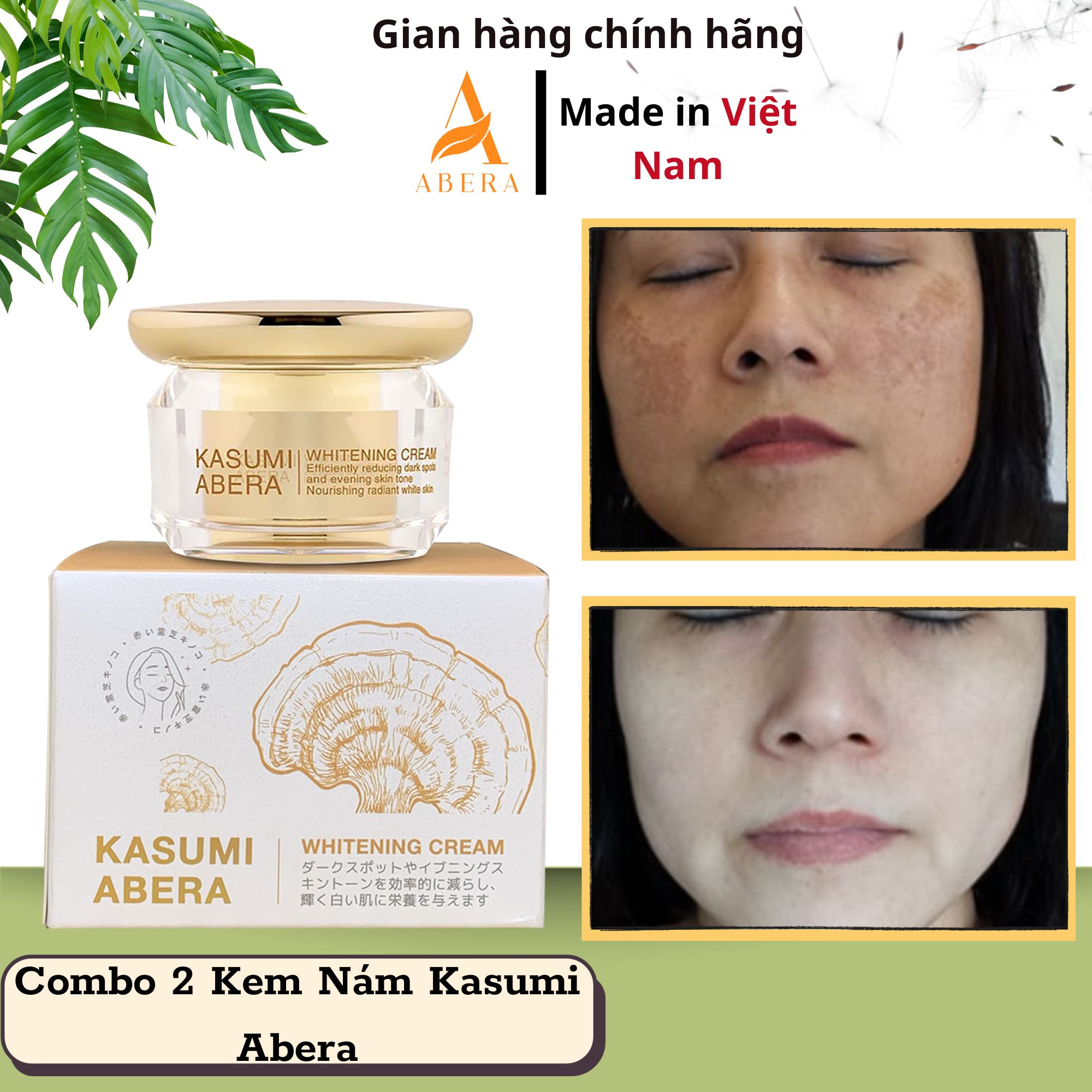 Combo 2 kem nám da kasumi abera giảm nhanh vết nám da, tàn nhang, đồi mồi & dưỡng da trắng sáng