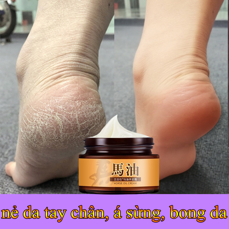 Kem dầu ngựa bôi nứt gót chân,kem dưỡng da tay và gót chân 30ml kem dưỡng giảm nứt gót chân và tay nứt gót chân, săn chắc khôi phục hư tổn nhanh chóng, nẻ da tay chân, á sừng, bong da, dưỡng ẩm dưỡng ẩm làm trắng tẩy