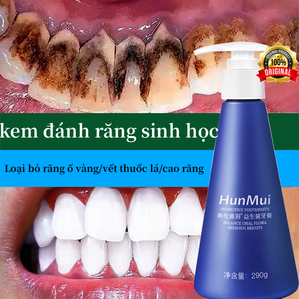 Kem đánh răng trắng răng 290g tẩy trắng răng tẩy trắng răng tại nhà tẩy cao răng Giữ gìn vệ sinh răng miệng