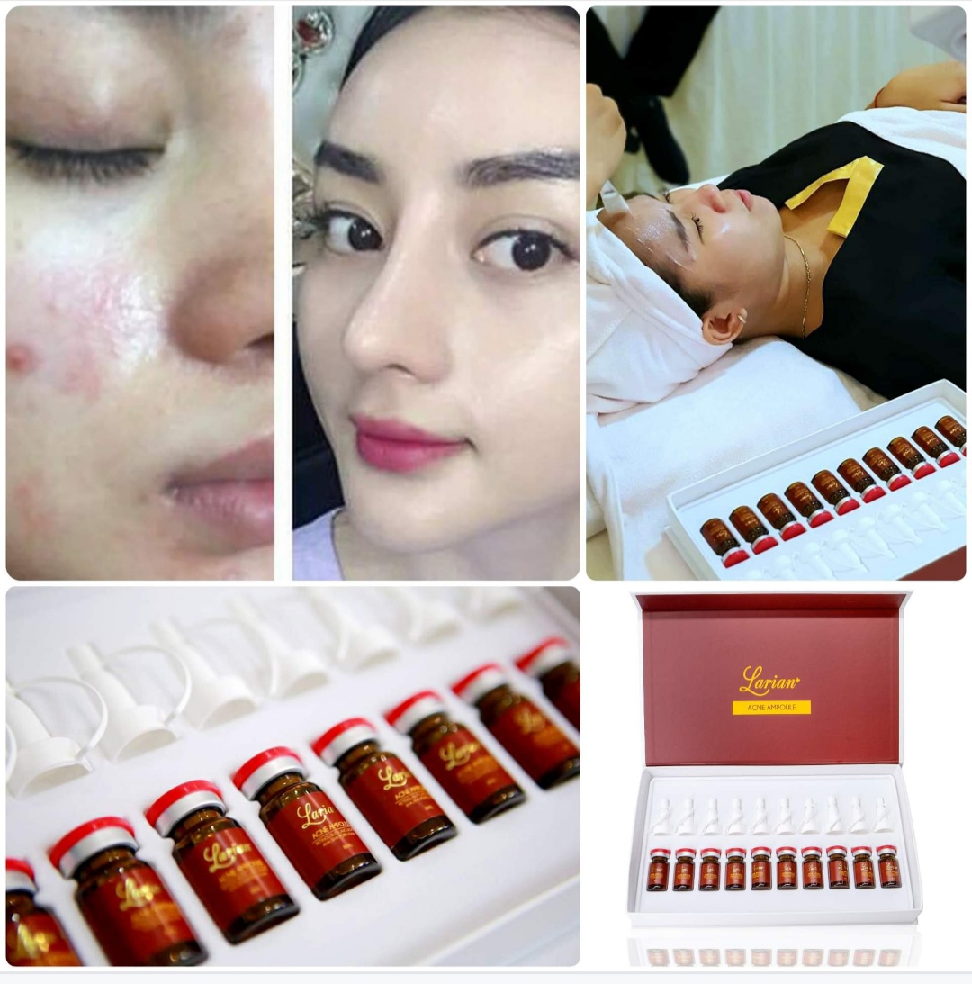 Tế bào gốc trị mụn dna larian hộp 10 lọ
