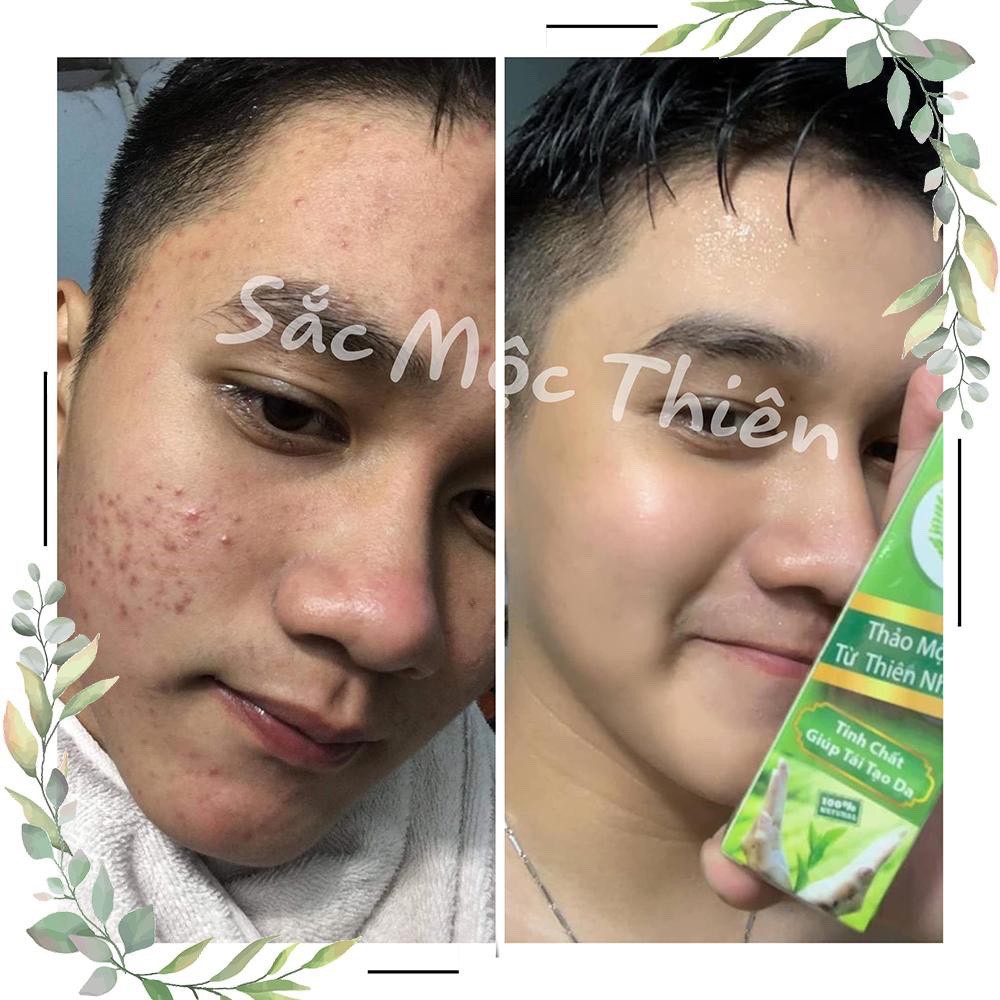 Tái tạo da 30ml sắc mộc thiên chính hãng