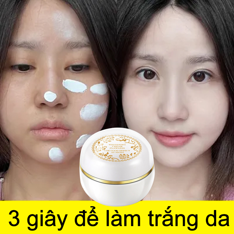 kem làm trắng cấp tốc kem dưỡng ẩm dành cho da mặt lem loại bỏ nám và tàn nhang, nam nữ cấp nước nhanh chóng khóa nước dài lâu kiềm dầu che khuyết làm sáng da săn chắc da chống lão hóa ngăn ngừa nếp nhăn da 30g