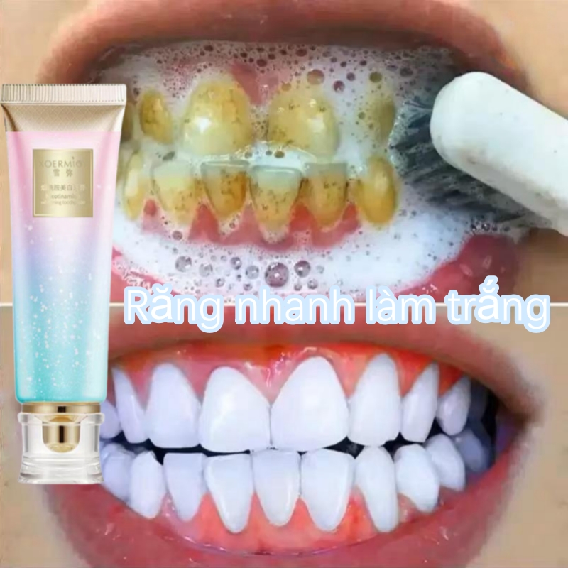 Làm trắng răng Kem đánh răng Kem đánh răng Nicotinamide Loại bỏ răng màu vàng Giai điệu mới Bảo vệ răng/Teeth whitening