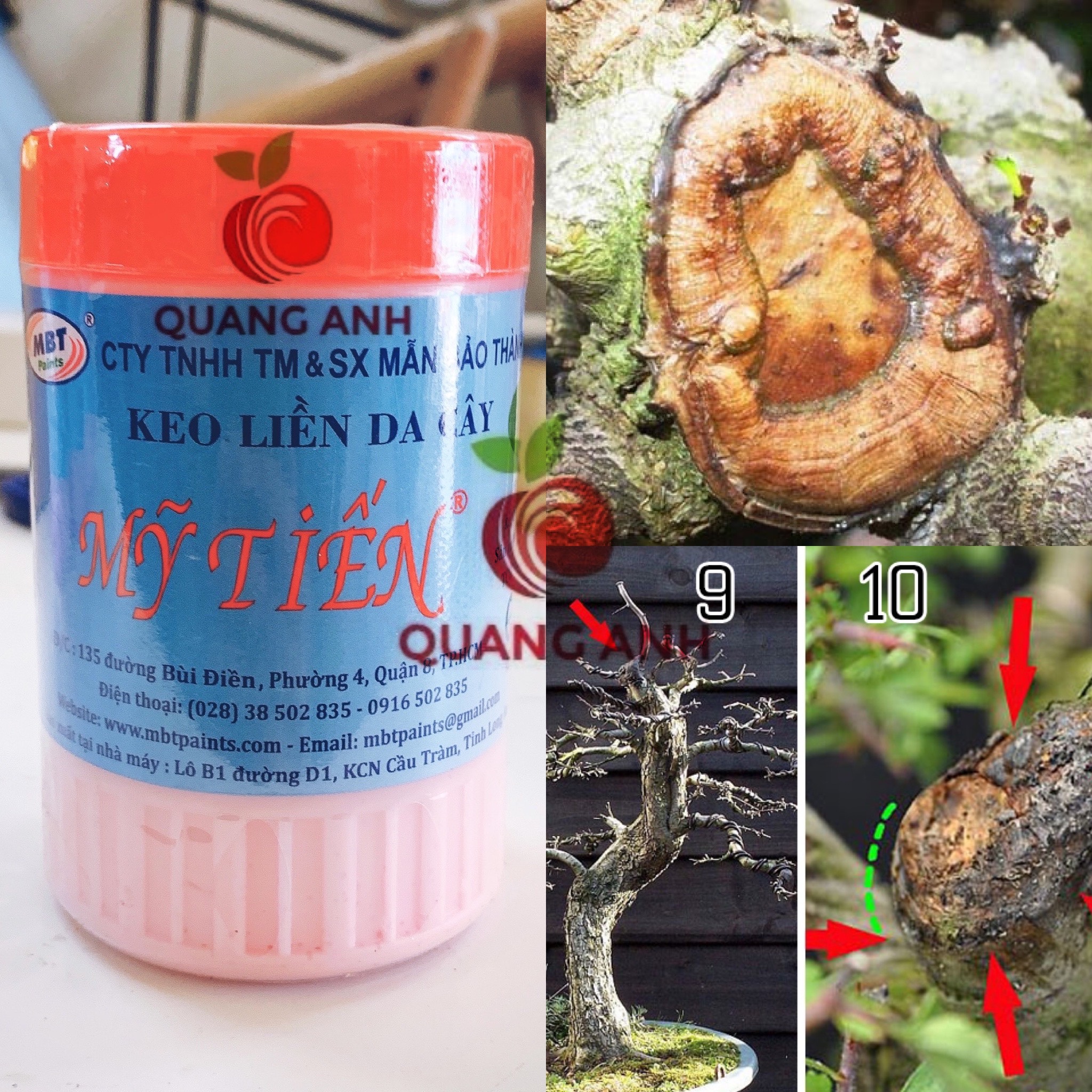 Keo liền da cây - keo liền sẹo mỹ tiến lọ 225gr