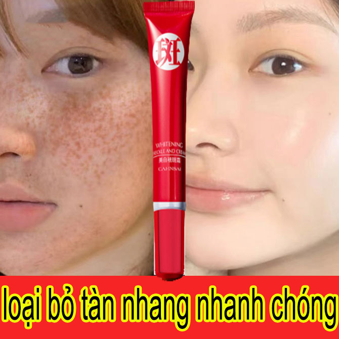 Kem làm trắng da loại bỏ nhanh chóng các đốm tàn nhang 【Chăm sóc da phụ nữ và phụ nữ mang thai】 Kem xóa tàn nhang Kem xóa vết nám Nhanh chóng loại bỏ vết thâm và hắc tố Melanin , thu nhỏ lô chân lông và làm săn chắc da giúp trắng sáng da Chống lão hóa
