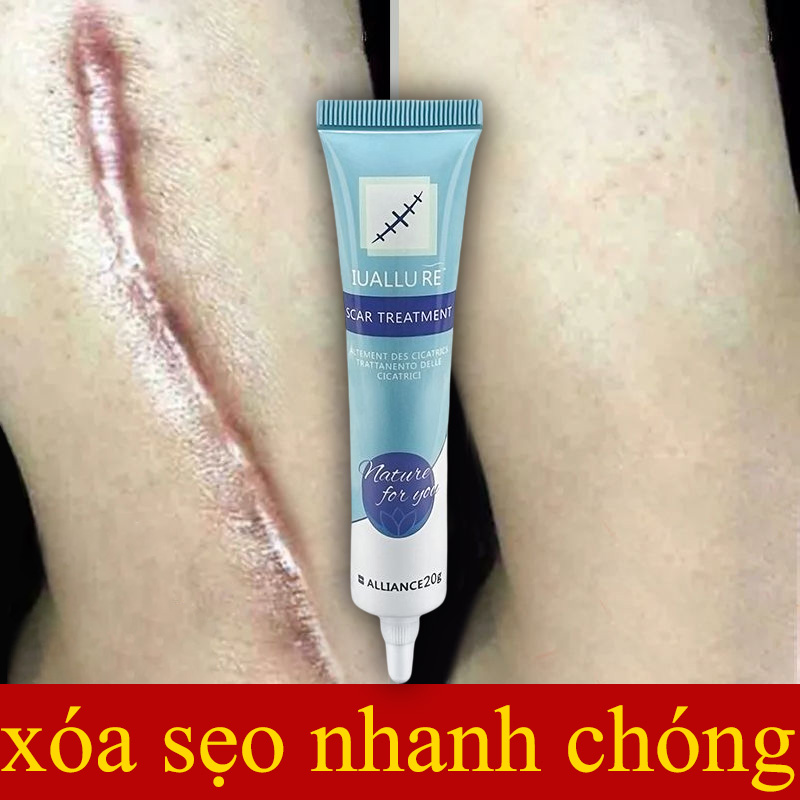 Kem giảm mụn thâm sẹo rỗ, Kem dưỡng làm dịu và phục hồi nhanh da tổn thương Kem xóa mờ sẹo 20g làm mờ sẹo lồi, sẹo rỗ, sẹo thâm lâu năm, hỗ trợ làm phẳng mềm và mờ sẹo lồi sẹo thâm sẹo phì đại