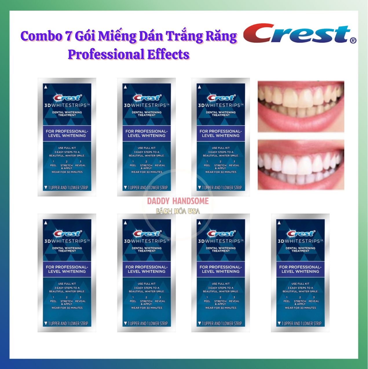 Combo 7 gói miếng dán trắng răng Crest 3D White loại Professional Effects