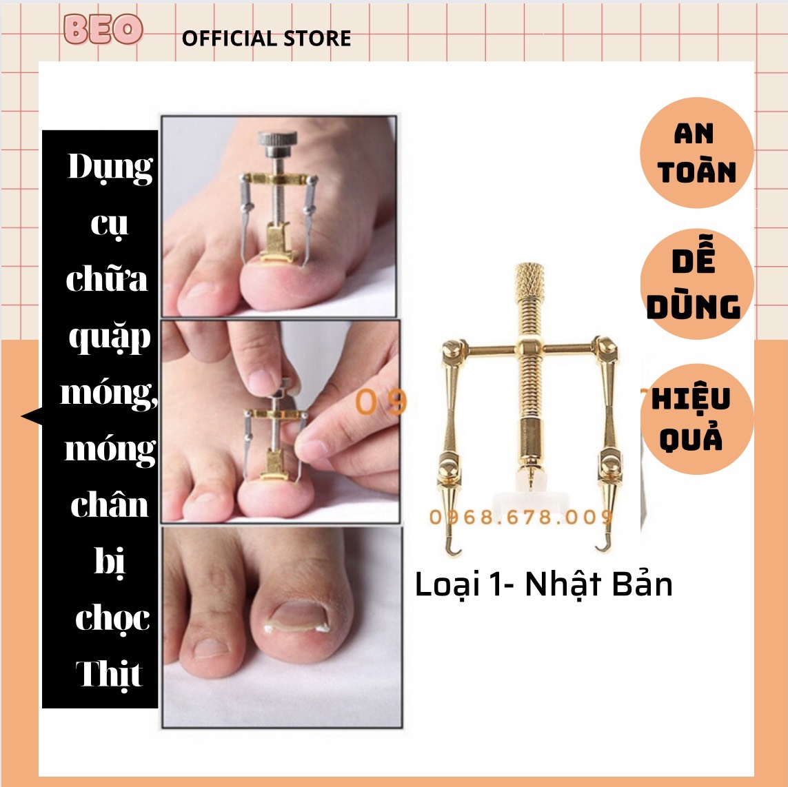 Bộ dụng cụ chữa móng chân bị chọc thịt gây tổn thương đau đơn -móng chân bị quặp thịt