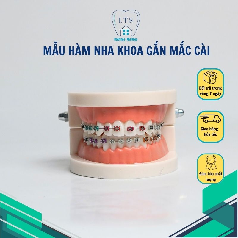 Mẫu hàm nha khoa có gắn Mắc cài để tư vấn , trưng bày, học tập