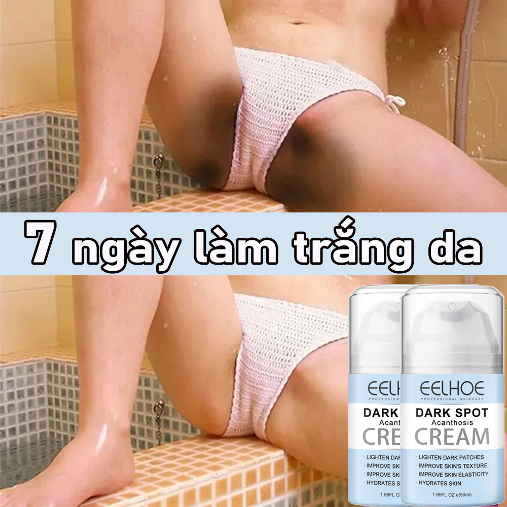 Kem làm trắng da Kem Thâm Nách kem làm trắng vùng kín bikini 50g Nuôi dưỡng và tái tạo da trắng sáng