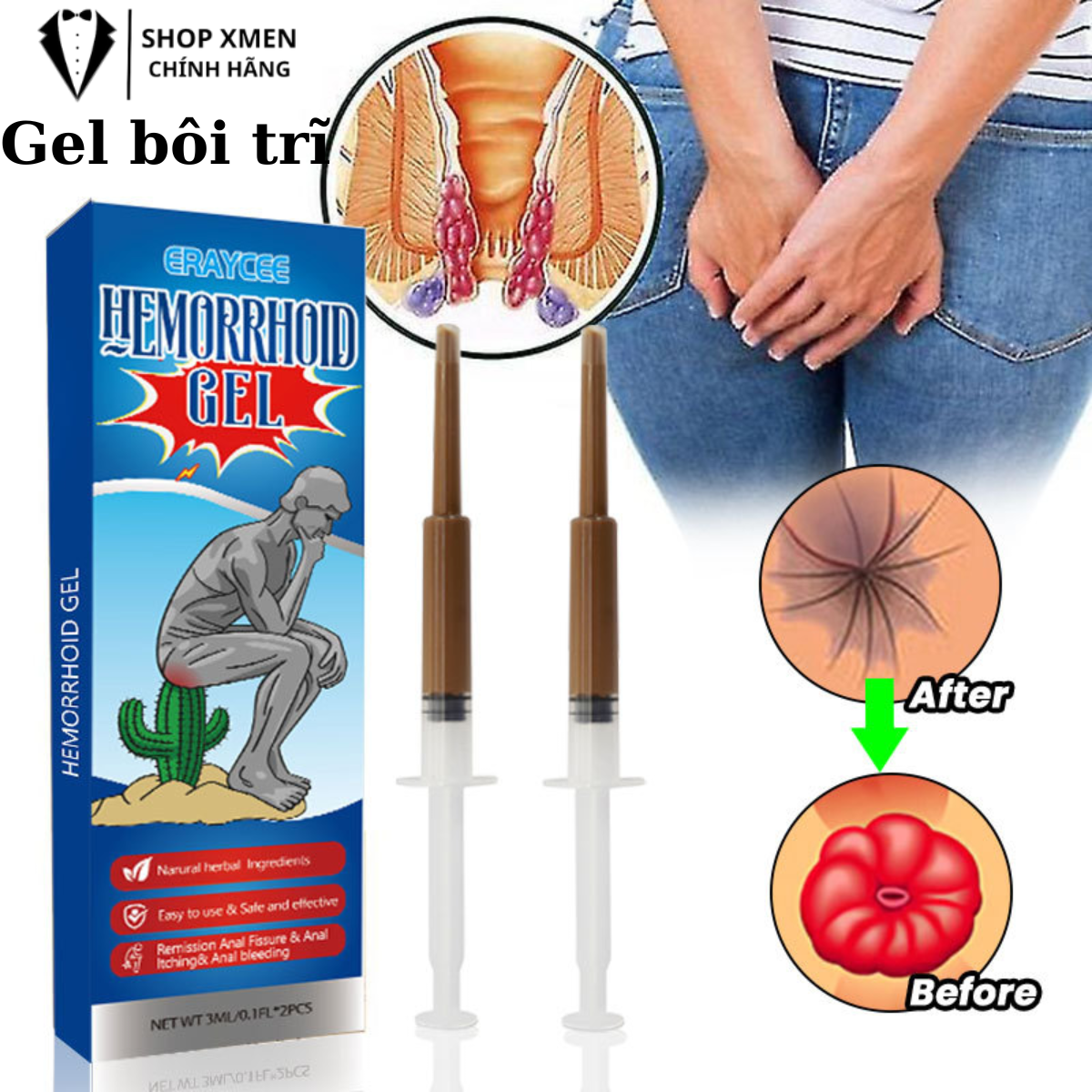 Kem bôi trĩ , trĩ nội, trĩ ngoại, trĩ hỗn hợp, giảm sưng đau búi trĩ, cải thiện tình trạng đau rát vùng h,ậu m.ôn