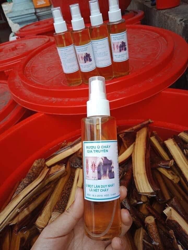 SẠCH HẾT CHẤY VÀ TRỨNG CHỈ SAU 1 LẦN Ủ TÓC VỚI THẢO DƯỢC