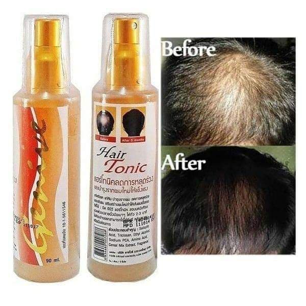 Xịt Mọc Tóc, T.r.ị Hói Đầu GENIVE HAIR TONIC Thái Lan