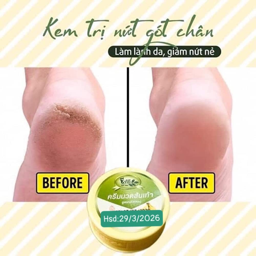 Kem hổ trợ nứt gót chân chuối thái lan