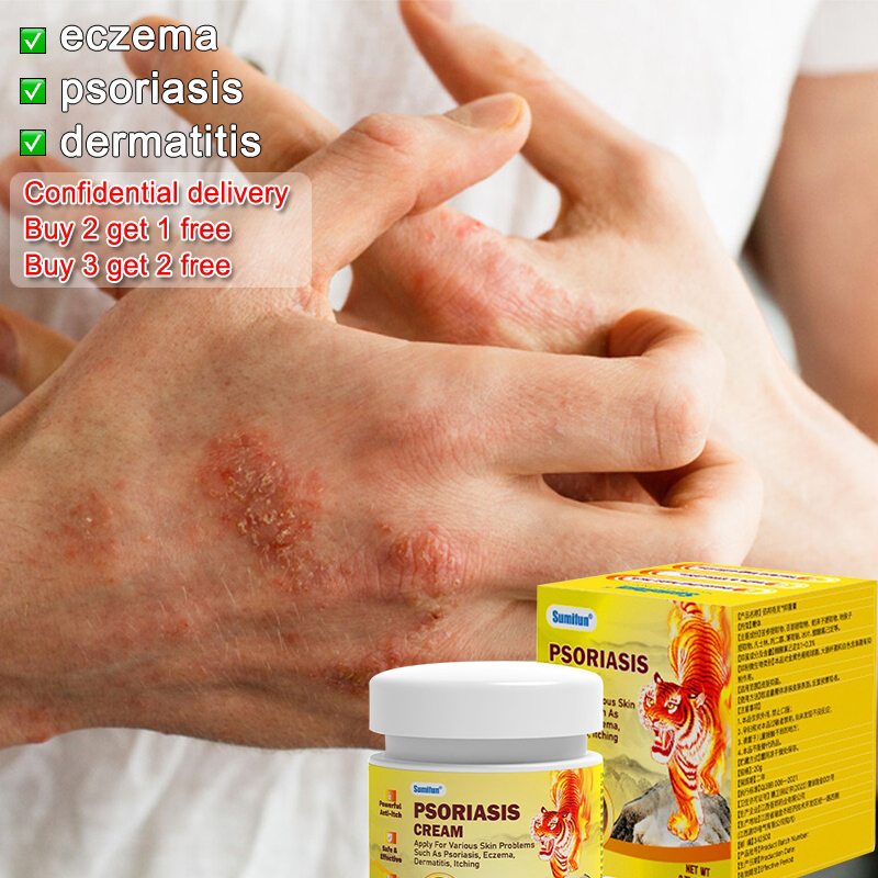 Kem bôi da ngứa Kem bôi viêm da cơ địa Kem bôi vẩy nến thuốc nấm bẹn ở nam hắc lào lang ben 20g