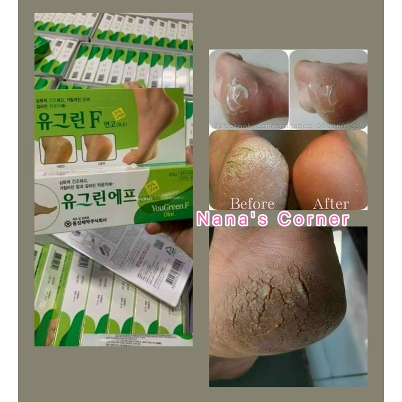 [FreeShip +Quà 19k] Kem bôi chân bị nứt nẻ CASO V.N.A QP09 giúp loại bỏ lớp da bị sừng hóa, sần sùi, chai lỳ, cho bàn chân mềm mại