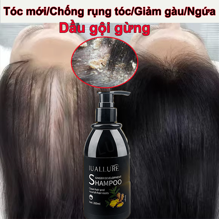 Dầu gội đầu dầu gội đầu trị gàu Dầu gội gừng 200ml Dầu gội đầu ngứa Giảm Rụng Tóc Kích Thích Mọc Tóc Giảm Gàu Giảm Bết Dầu