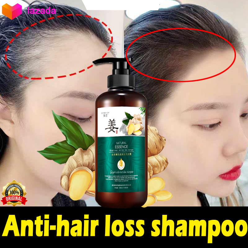 Dầu gội gừng Làm sạch da đầu tẩy tế bào chết ngứaChống rụng tóc 500  ml sau sinh Chống khô tóc chân tóc chắc chắn kích thích sự phát triển của tóc ngăn ngừa rụng tóc giải quyết vấn đề hói đầu giữ ẩm da đầu làm mịn tóc