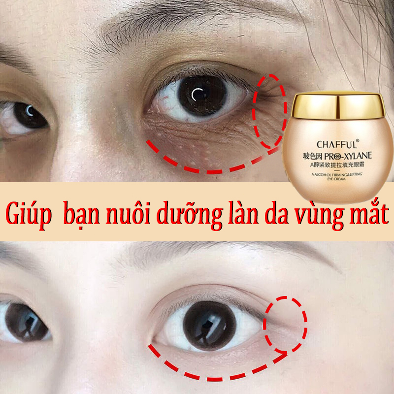 60g eye cream dark circles eye treatment cream anti