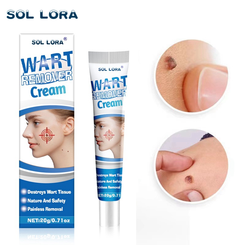 SOL LORA  AliExpress Yama Independent Station Wart Removal Cream   Verruca Flat Wart Removing Verruca Verruca Paste Corns Mole Remover Cream